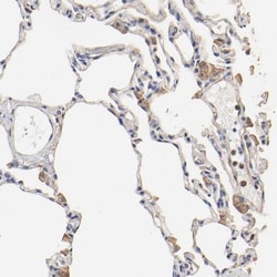 transgelin 2 Antibody, Novus Biologicals 0.1mL; Unlabeled:Antibodies, Polyclonal
